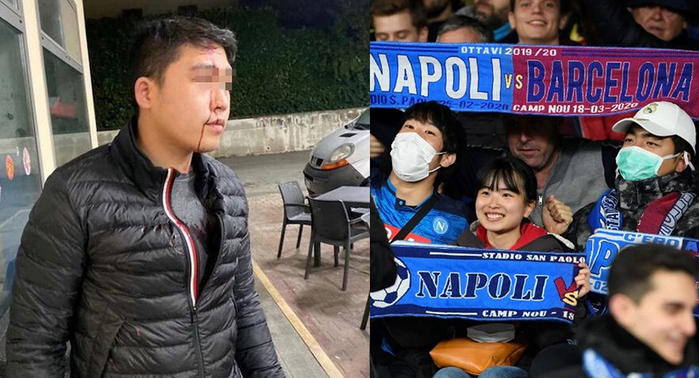 Il razzismo non è nel nostro DNA, cosa che non si può dire di altre regioni