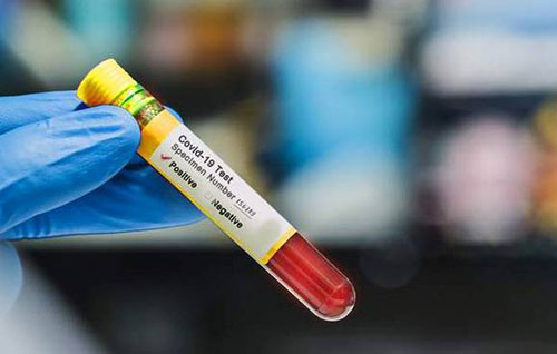 Altro caso di Coronavirus sull’isola d’Ischia