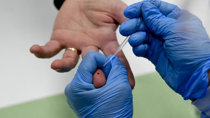 Al via i test rapidi sierologici, ma senza evidenze scientifiche certe