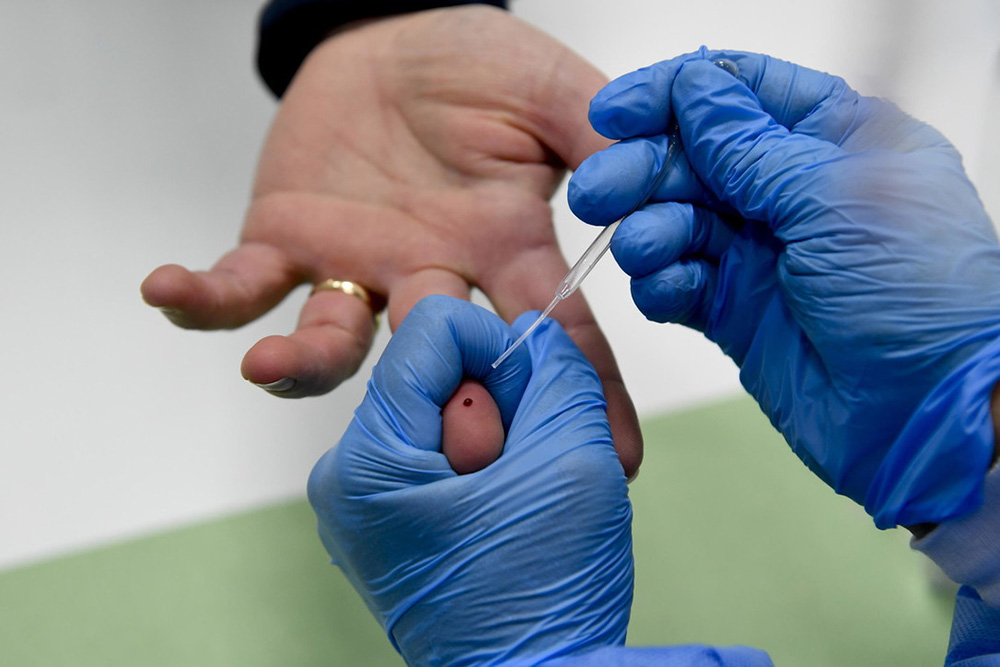 Al via i test rapidi sierologici, ma senza evidenze scientifiche certe