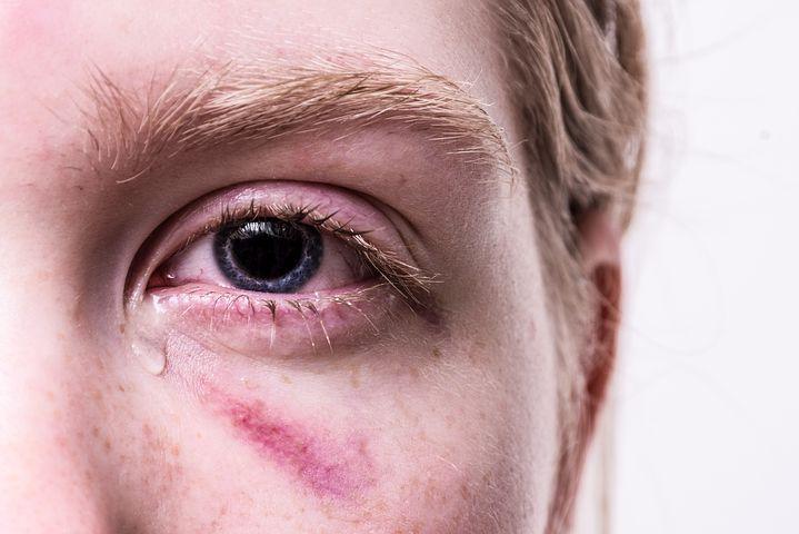 Il reddito di libertà per le donne vittime di violenza