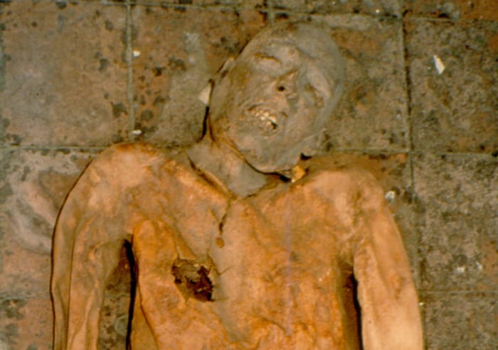 Diagnosi sulla mummia di Giovanni d’Avalos, scoperta un’infezione di Escherichia coli dopo 5 secoli