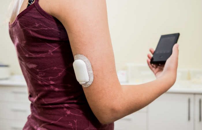 Anche ad Ischia finalmente il sensore CGM per controllare la glicemia senza alcuna puntura