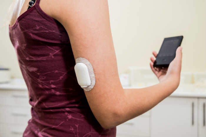 Anche ad Ischia finalmente il sensore CGM per controllare la glicemia senza alcuna puntura
