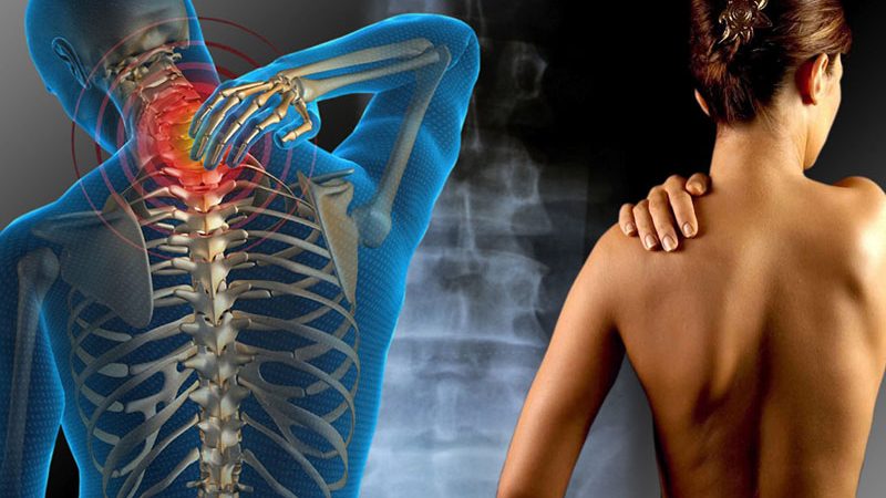 Fibromialgia la sindrome dalle 100 malattie. Il calvario di Anna