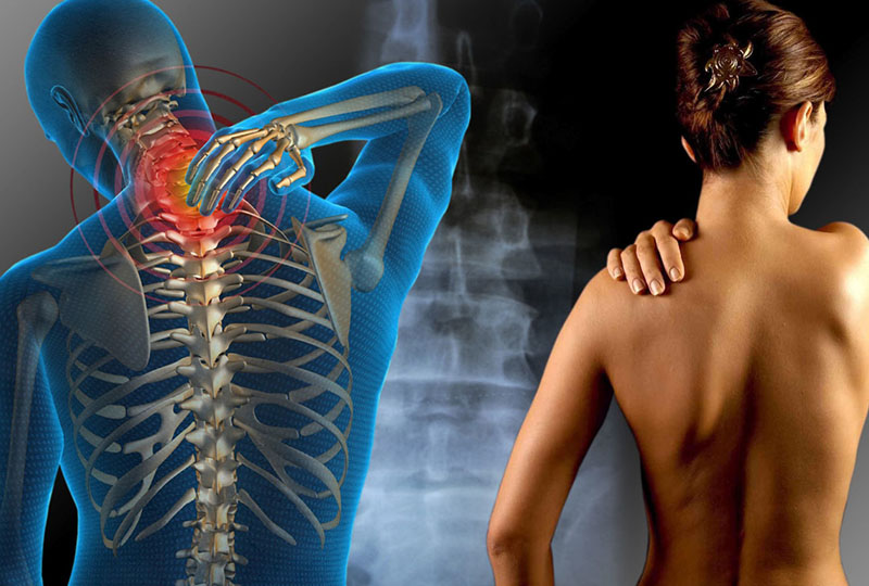 Fibromialgia la sindrome dalle 100 malattie. Il calvario di Anna